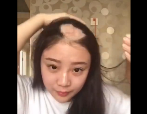 µ